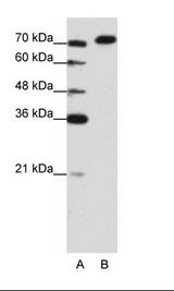 AKAP8L Antibody - A: Marker, B: Jurkat Cell Lysate.  This image was taken for the unconjugated form of this product. Other forms have not been tested.