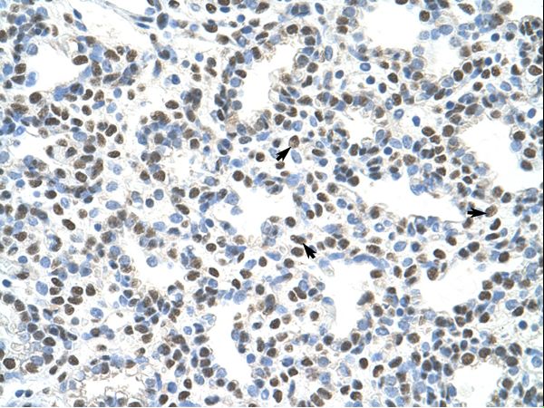 AKAP8L Antibody - AKAP8L antibody ARP39080_T100-NP_055186-AKAP8L (A kinase (PRKA) anchor protein 8-like) Antibody was used in IHC to stain formalin-fixed, paraffin-embedded human lung.  This image was taken for the unconjugated form of this product. Other forms have not been tested.