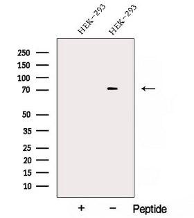 AKAP8L Antibody - Western blot analysis of extracts of HEK293 cells using AKAP8L antibody. The lane on the left was treated with blocking peptide.