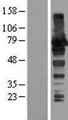 AKAP8L Protein - Western validation with an anti-DDK antibody * L: Control HEK293 lysate R: Over-expression lysate