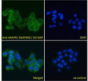 AKAP9 / YOTIAO Antibody - AKAP9 / YOTIAO antibody immunofluorescence analysis of paraformaldehyde fixed A431 cells, permeabilized with 0.15% Triton. Primary incubation 1hr (10ug/ml) followed by Alexa Fluor 488 secondary antibody (4ug/ml), showing cytoplasmic and Golgi apparatus staining. The nuclear stain is DAPI (blue). Negative control: Unimmunized goat IgG (10ug/ml) followed by Alexa Fluor 488 secondary antibody (4ug/ml).