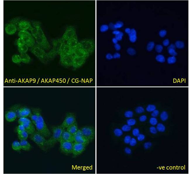 AKAP9 / YOTIAO Antibody - AKAP9 / YOTIAO antibody immunofluorescence analysis of paraformaldehyde fixed A431 cells, permeabilized with 0.15% Triton. Primary incubation 1hr (10ug/ml) followed by Alexa Fluor 488 secondary antibody (4ug/ml), showing cytoplasmic and Golgi apparatus staining. The nuclear stain is DAPI (blue). Negative control: Unimmunized goat IgG (10ug/ml) followed by Alexa Fluor 488 secondary antibody (4ug/ml).
