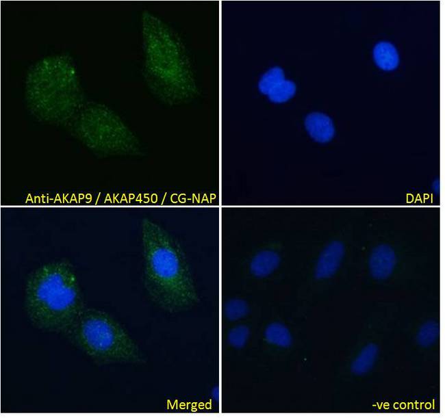AKAP9 / YOTIAO Antibody - AKAP9 / YOTIAO antibody immunofluorescence analysis of paraformaldehyde fixed U2OS cells, permeabilized with 0.15% Triton. Primary incubation 1hr (10ug/ml) followed by Alexa Fluor 488 secondary antibody (4ug/ml), showing cytoplasmic staining. The nuclear stain is DAPI (blue). Negative control: Unimmunized goat IgG (10ug/ml) followed by Alexa Fluor 488 secondary antibody (2ug/ml).