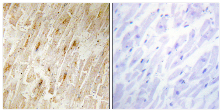 AKIP1 / BCA3 Antibody - Immunohistochemistry analysis of paraffin-embedded human heart tissue, using BCA3 Antibody. The picture on the right is blocked with the synthesized peptide.