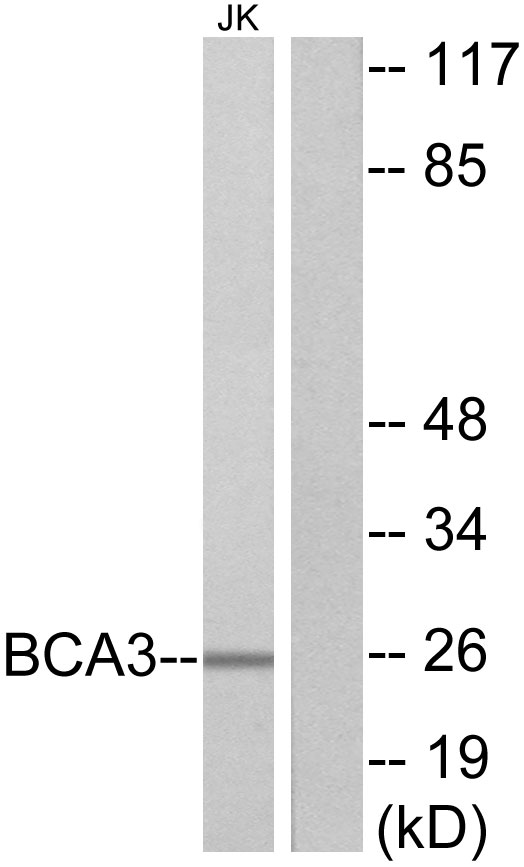 AKIP1 / BCA3 Antibody - Western blot analysis of lysates from Jurkat cells, using BCA3 Antibody. The lane on the right is blocked with the synthesized peptide.