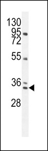 AKIP1 / BCA3 Antibody - BCA3 Antibody western blot of NCI-H292 cell line lysates (35 ug/lane). The BCA3 antibody detected the BCA3 protein (arrow).