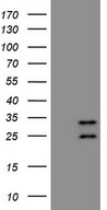 AKIP1 / BCA3 Antibody - HEK293T cells were transfected with the pCMV6-ENTRY control. (Left lane) or pCMV6-ENTRY AKIP1. (Right lane) cDNA for 48 hrs and lysed. Equivalent amounts of cell lysates. (5 ug per lane) were separated by SDS-PAGE and immunoblotted with anti-AKIP1. (1:500)