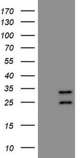 AKIP1 / BCA3 Antibody - HEK293T cells were transfected with the pCMV6-ENTRY control. (Left lane) or pCMV6-ENTRY AKIP1. (Right lane) cDNA for 48 hrs and lysed