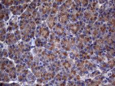 AKIP1 / BCA3 Antibody - Immunohistochemical staining of paraffin-embedded Human pancreas tissue within the normal limits using anti-AKIP1 mouse monoclonal antibody. (Heat-induced epitope retrieval by 1mM EDTA in 10mM Tris buffer. (pH8.5) at 120°C for 3 min. (1:150)