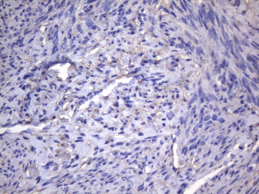 AKIP1 / BCA3 Antibody - Immunohistochemical staining of paraffin-embedded Human endometrium tissue within the normal limits using anti-AKIP1 mouse monoclonal antibody. (Heat-induced epitope retrieval by 1mM EDTA in 10mM Tris buffer. (pH8.5) at 120°C for 3 min. (1:150)