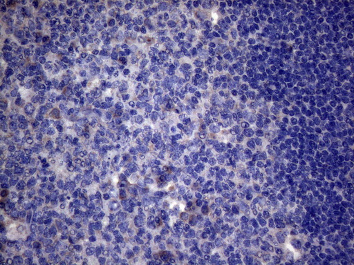 AKIP1 / BCA3 Antibody - Immunohistochemical staining of paraffin-embedded Human tonsil within the normal limits using anti-AKIP1 mouse monoclonal antibody. (Heat-induced epitope retrieval by 1mM EDTA in 10mM Tris buffer. (pH8.5) at 120°C for 3 min. (1:150)