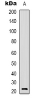 AKIP1 / BCA3 Antibody - Western blot analysis of BCA3 expression in A549 (A) whole cell lysates.