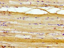 AKIP1 / BCA3 Antibody - Immunohistochemistry image of paraffin-embedded human skeletal muscle tissue at a dilution of 1:100