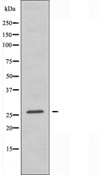 AKIP1 / BCA3 Antibody - Western blot analysis of extracts of Jurkat cells using BCA3 antibody.