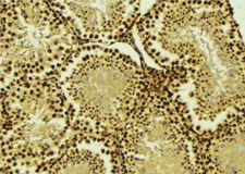 AKIP1 / BCA3 Antibody - 1:100 staining mouse testis tissue by IHC-P. The sample was formaldehyde fixed and a heat mediated antigen retrieval step in citrate buffer was performed. The sample was then blocked and incubated with the antibody for 1.5 hours at 22°C. An HRP conjugated goat anti-rabbit antibody was used as the secondary.