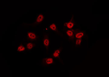 AKIP1 / BCA3 Antibody - Staining HeLa cells by IF/ICC. The samples were fixed with PFA and permeabilized in 0.1% Triton X-100, then blocked in 10% serum for 45 min at 25°C. The primary antibody was diluted at 1:200 and incubated with the sample for 1 hour at 37°C. An Alexa Fluor 594 conjugated goat anti-rabbit IgG (H+L) Ab, diluted at 1/600, was used as the secondary antibody.