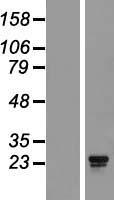 AKIP1 / BCA3 Protein - Western validation with an anti-DDK antibody * L: Control HEK293 lysate R: Over-expression lysate