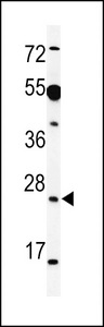 AKIRIN1 Antibody - Western blot of AKIR1 Antibody in HeLa cell line lysates (35 ug/lane). AKIR1 (arrow) was detected using the purified antibody.
