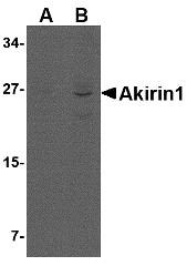 AKIRIN1 Antibody - Western blot analysis of Akirin1 in A549 cell lysate.