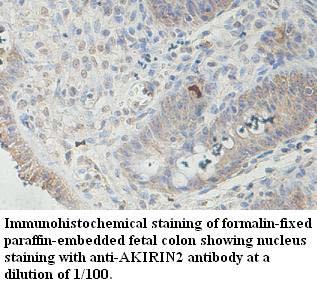 AKIRIN2 Antibody