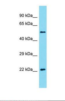 AKIRIN2 Antibody - Western blot of Mouse Spleen. Akirin2 antibody dilution 1.0 ug/ml.  This image was taken for the unconjugated form of this product. Other forms have not been tested.