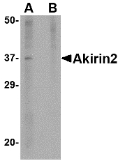 AKIRIN2 Antibody - Western blot of Akirin2 in mouse brain tissue lysate with Akirin2 antibody at 1 ug/ml in (A) the absence and (B) the presence of blocking peptide.