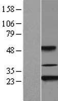 AKIRIN2 Protein - Western validation with an anti-DDK antibody * L: Control HEK293 lysate R: Over-expression lysate