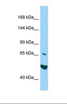 AKNA / KIAA1968 Antibody - Western blot of Human HepG2. AKNA antibody dilution 1.0 ug/ml.  This image was taken for the unconjugated form of this product. Other forms have not been tested.
