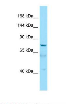 AKNA / KIAA1968 Antibody - Western blot of Human HepG2. AKNA antibody dilution 1.0 ug/ml.  This image was taken for the unconjugated form of this product. Other forms have not been tested.