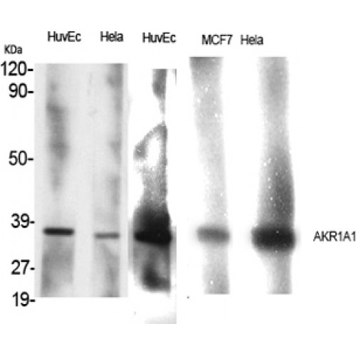 AKR1A1 Antibody - Western blot of AKR1A1 antibody
