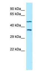 AKR1A1 Antibody - AKR1A1 antibody Western Blot of U937.  This image was taken for the unconjugated form of this product. Other forms have not been tested.