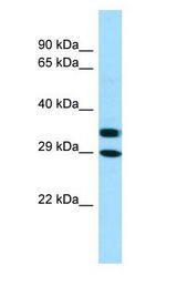 AKR1A1 Antibody - AKR1A1 antibody Western Blot of THP-1.  This image was taken for the unconjugated form of this product. Other forms have not been tested.