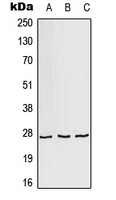 AKR1A1 Antibody - Western blot analysis of AKR1A1 expression in HeLa (A); Raw264.7 (B); H9C2 (C) whole cell lysates.