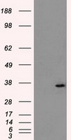 AKR1A1 Antibody - HEK293T cells were transfected with the pCMV6-ENTRY control (Left lane) or pCMV6-ENTRY AKR1A1 (Right lane) cDNA for 48 hrs and lysed. Equivalent amounts of cell lysates (5 ug per lane) were separated by SDS-PAGE and immunoblotted with anti-AKR1A1.