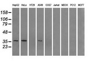 AKR1A1 Antibody - Western blot of extracts (35 ug) from 9 different cell lines by using anti-AKR1A1 monoclonal antibody.