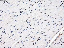 AKR1A1 Antibody - IHC of paraffin-embedded Human colon tissue using anti-AKR1A1 mouse monoclonal antibody.