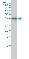 AKR1A1 Antibody - AKR1A1 monoclonal antibody (M01), clone 1A11-2A4 Western blot of AKR1A1 expression in HL-60.