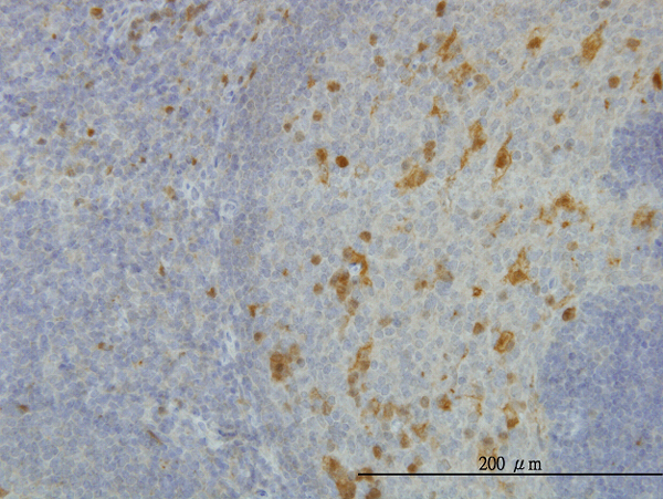 AKR1A1 Antibody - Immunoperoxidase of monoclonal antibody to AKR1A1 on formalin-fixed paraffin-embedded human tonsil. [antibody concentration 0.75 ug/ml]