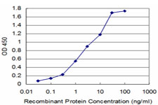 AKR1A1 Antibody - Detection limit for recombinant GST tagged AKR1A1 is approximately 0.1 ng/ml as a capture antibody.