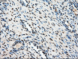 AKR1A1 Antibody - IHC of paraffin-embedded Ovary tissue using anti-AKR1A1 mouse monoclonal antibody. (Dilution 1:50).