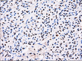 AKR1A1 Antibody - IHC of paraffin-embedded endometrium tissue using anti-AKR1A1 mouse monoclonal antibody. (Dilution 1:50).