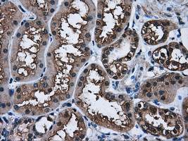 AKR1A1 Antibody - IHC of paraffin-embedded Kidney tissue using anti-AKR1A1 mouse monoclonal antibody. (Dilution 1:50).