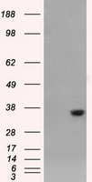 AKR1A1 Antibody - HEK293T cells were transfected with the pCMV6-ENTRY control (Left lane) or pCMV6-ENTRY AKR1A1 (Right lane) cDNA for 48 hrs and lysed. Equivalent amounts of cell lysates (5 ug per lane) were separated by SDS-PAGE and immunoblotted with anti-AKR1A1.