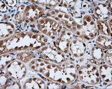 AKR1A1 Antibody - IHC of paraffin-embedded Kidney tissue using anti-AKR1A1 mouse monoclonal antibody. (Dilution 1:50).