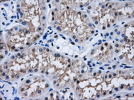 AKR1A1 Antibody - IHC of paraffin-embedded Kidney tissue using anti-AKR1A1 mouse monoclonal antibody. (Dilution 1:50).