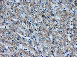 AKR1A1 Antibody - IHC of paraffin-embedded liver tissue using anti-AKR1A1 mouse monoclonal antibody. (Dilution 1:50).