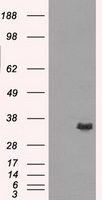 AKR1A1 Antibody - HEK293T cells were transfected with the pCMV6-ENTRY control (Left lane) or pCMV6-ENTRY AKR1A1 (Right lane) cDNA for 48 hrs and lysed. Equivalent amounts of cell lysates (5 ug per lane) were separated by SDS-PAGE and immunoblotted with anti-AKR1A1.