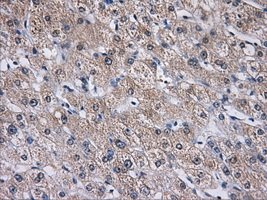 AKR1A1 Antibody - IHC of paraffin-embedded liver tissue using anti-AKR1A1 mouse monoclonal antibody. (Dilution 1:50).