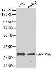 AKR1A1 Antibody - Western blot of AKR1A1 pAb in extracts from Y79 and Jurkat cells.