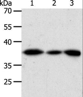 AKR1A1 Antibody - Western blot analysis of Human liver cancer tissue, HeLa cell and human fetal kidney tissue, using AKR1A1 Polyclonal Antibody at dilution of 1:450.